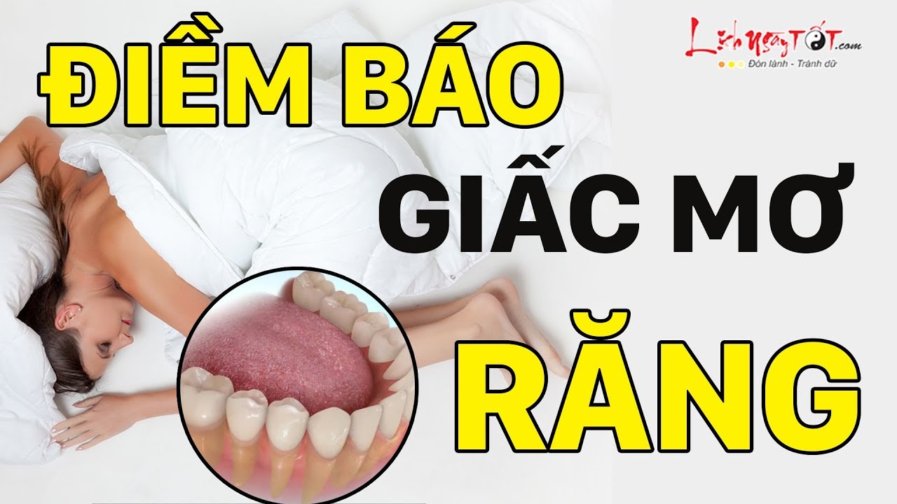 Nằm mơ thấy rụng răng hàm trên Điều gì đang chờ đợi bạn?